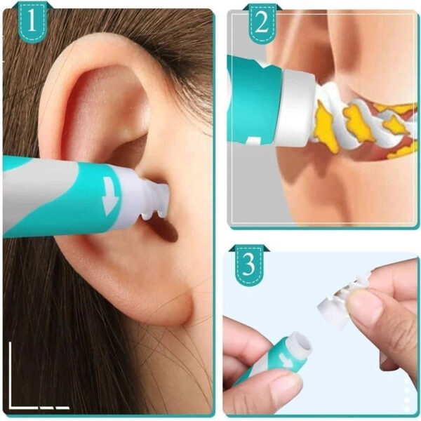 Orodje za odstranjevanje ušesnega masla HTL 24012703 glavna slika 5